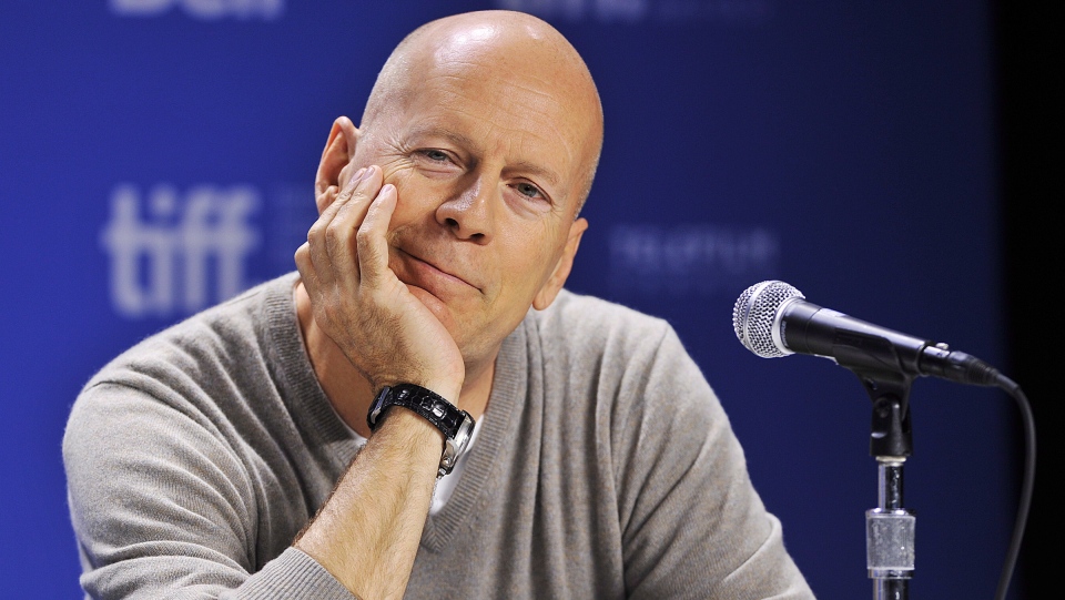 What is aphasia? Bruce Willis’ diagnosis, explained - Antigua News Room